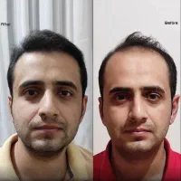 کلینیک/ جراحی بینی / ترمیم / تزریق ژل لب /|خدمات آرایشگری و زیبایی|تهران, سعادتآباد|دیوار