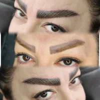 فیبروزابروفقط به مدت محدود۱۲۰۰میلیون