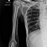 رادیولوژی در منزل|خدمات آرایشگری و زیبایی|قم, سالاریه|دیوار