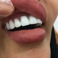 لابراتوار پروتزمتحرک|خدمات آرایشگری و زیبایی|گلستان (تهران), |دیوار