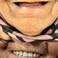 کلنیک دندانپزشکی ودندانسازی، دندان مصنوعی