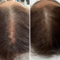 مرکز تخصصی ژل بوتاکس /کاشت امبدینگ لاغری در مطب|خدمات آرایشگری و زیبایی|کرمانشاه, |دیوار