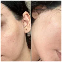 پاکسازی صورت