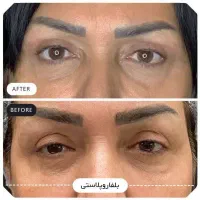 جشنواره کلینیک زیبایی مهسان|خدمات آرایشگری و زیبایی|قم, صدوق|دیوار