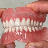 دندانسازی الماس