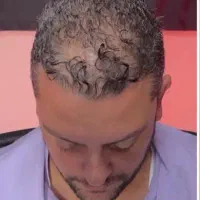 پرپشت شو