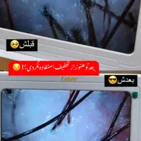 خدمات اسکراب اسکالپ|خدمات آرایشگری و زیبایی|رشت, گلباغ نماز|دیوار