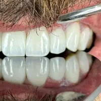 دندانپزشکی اقساط ۱۲ماهه بدون پیش پرداخت|خدمات آرایشگری و زیبایی|تهران, خانی آباد نو شمالی|دیوار