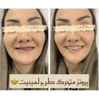 دندانسازی علی نیکو