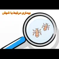 شامپوی ضد شپش و حتی پوچ کننده تخم شپش تضمینی|آرایشی، بهداشتی، درمانی|خرمدره, |دیوار