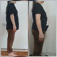 لاغری