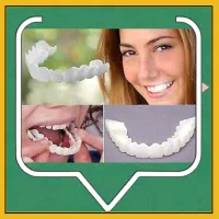 لمینت فوری دندان ترواسمایل اصل (۴ قسط بدون کارمزد)