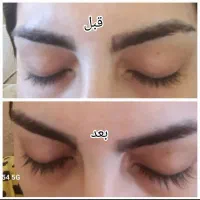 سرم رویش مجدد