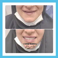 دندانسازی تخصصی سانترال