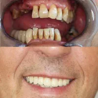 جشنواره دندانپزشکی اقساط دندان پزشکی همه خدمات|خدمات آرایشگری و زیبایی|اصفهان, دشتستان|دیوار