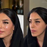 جشنواره بوتاکس مزو فیلر بادی بینی لب جراحی نیاوران|خدمات زیبایی و سلامت|تهران, دزاشیب|دیوار