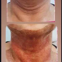 جوانسازی صورت بدون جراحی با تخفیف ویژه|خدمات آرایشگری و زیبایی|تهران, اقدسیه|دیوار