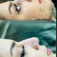 خدمات رایگان بوتاکس،ژل،فیلر توسط پزشک در ارومیه|خدمات آرایشگری و زیبایی|ارومیه, |دیوار