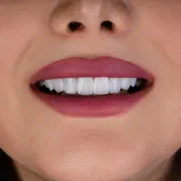 دندانپزشکی شاین . ترمیم دندان . کامپوزیت