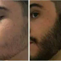 از ریزش و کم پشتی خسته نشدی