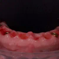 دندانپزشکی ایمپلنت روکش ارتودنسی اقساطی|خدمات آرایشگری و زیبایی|مرند, |دیوار