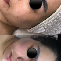 پاکسازی پوست ودرمانی پوست|خدمات آرایشگری و زیبایی|اهواز, کیانپارس |دیوار