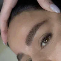 میکروبلیدینگ کار