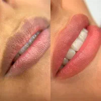 شیدینگ لب/رفع تیرگی بدون درد/تینت لب/فیکانتور لب