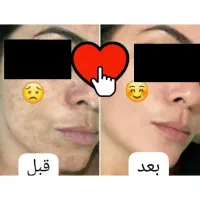 فرمول کرم سفید کننده صورت ودست پا|آرایشی، بهداشتی، درمانی|زاهدان, |دیوار