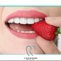 طرح تخفیف یلدایی کامپوزیت