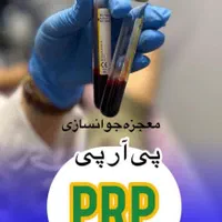 تتو ابر‌و میکروبلیدینگ شیدینگ ژل ومزو و وپی ارپی|خدمات آرایشگری و زیبایی|شوشتر, |دیوار
