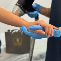 تجربه بی نظیر دستگاه لیزر کلینیک اقاو خانوم دکتر»