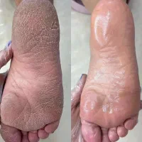 خدمات پدیکور و مانیکور و کاشت ناخن|خدمات آرایشگری و زیبایی|شاهینشهر, عطار|دیوار