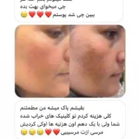 صابون لایه بردار گیاهی روشن کننده صورت وبدن|آرایشی، بهداشتی، درمانی|اهواز, آریاشهر|دیوار