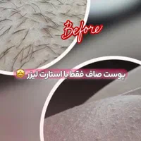 اپراتور خانوم