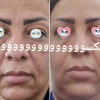 اصلاح مزاج با محصولات ارگانیک و گیاهی