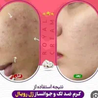 کرم ژل رویال روشن کننده پوست|آرایشی، بهداشتی، درمانی|تربت‌حیدریه, آغوی|دیوار