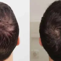 وقتشه موهات خودی نشون بدن