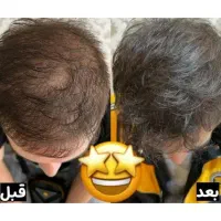 ضد ریزش و رویش مجدد مو آلمانی