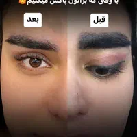 ریموو  هر نوع تتویی  کاملا تضمینی اف خورده|خدمات آرایشگری و زیبایی|کرمانشاه, |دیوار