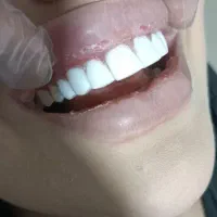 دندان سازی.دندان پزشکی|خدمات آرایشگری و زیبایی|خرم‌آباد, |دیوار