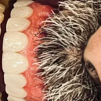 (زیبایی) ونییر کامپوزیت و لمینیت، بلیچینگ|خدمات آرایشگری و زیبایی|رشت, گلسار|دیوار