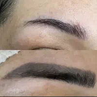 پاک کردن تضمینی تاتو با لیزر پیکوشور اصلی