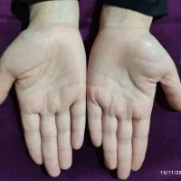 کف بینی و تحلیل خطوط دستان