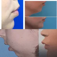 آموزش چهره شناسی|خدمات آموزشی|سبزوار, قصبه غربی|دیوار