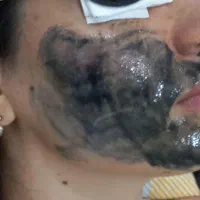 مرکز زیبایی ولاغری تضمینی کرایولیپولیز کیمیا|خدمات آرایشگری و زیبایی|رشت, گلباغ نماز|دیوار