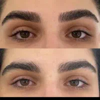 خدمات زیبایی. ریموو تتو های قدیمی