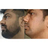پرپشتی کار ماست