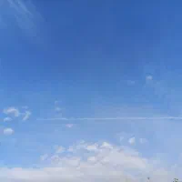 نیازمند وام جهت جراحی زانو