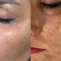کرم بیومیمتیک درمان ریشه ای ،نمایندگی